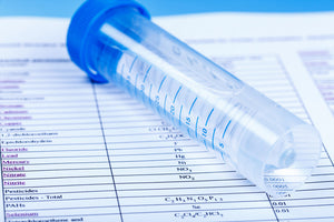 Key Things To Know About Getting Your Water Tested